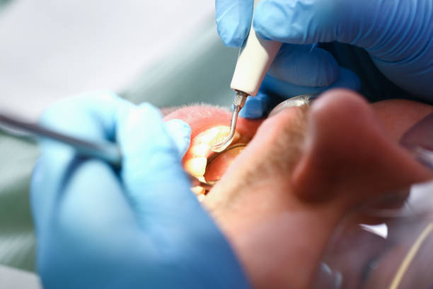 Best Emergency Broken Tooth Repair in Lincoln Park, NY
